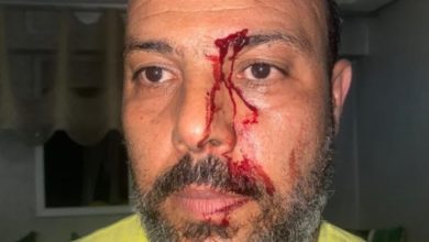 Photo of الزميل عادل العلوي، يتعرض للمرة الرابعة لاعتداء خطير